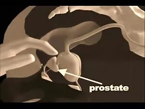 Połykać po sex ostre ...